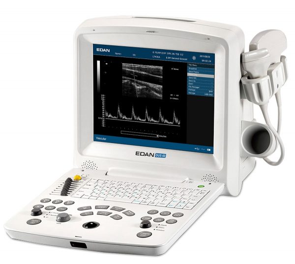 Edan DUS60 Ultrasound