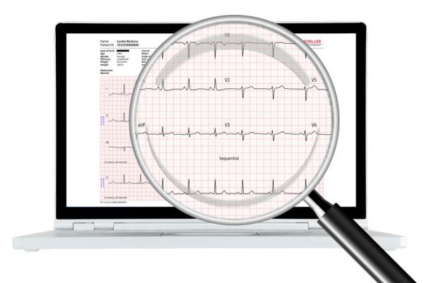 Schiller Cardiovit AT-102 G2 EKG - Image 2