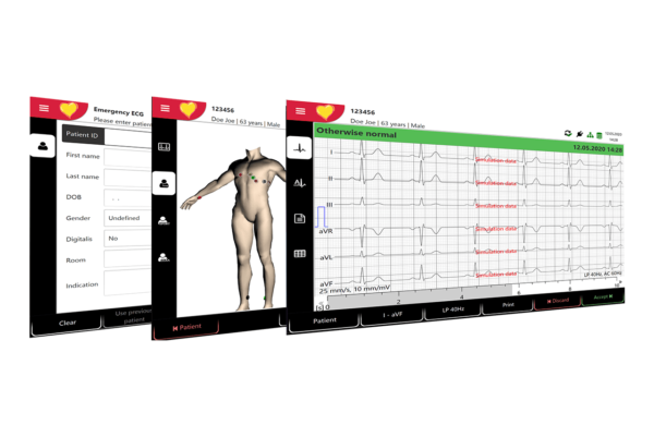 Schiller AT102G2 EKG Acquisition