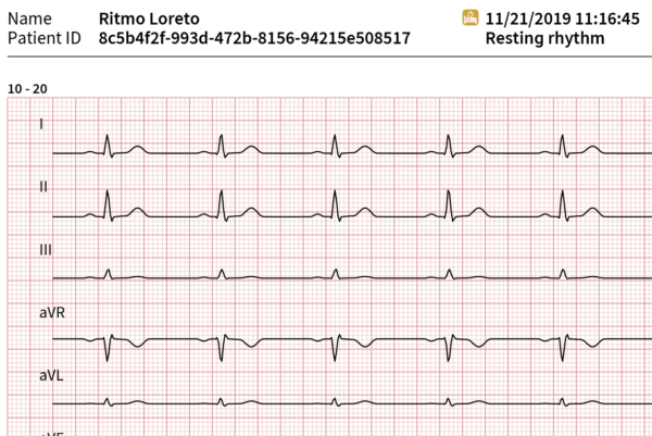 Schiller Cardiovit AT-102 G2 EKG - Image 6